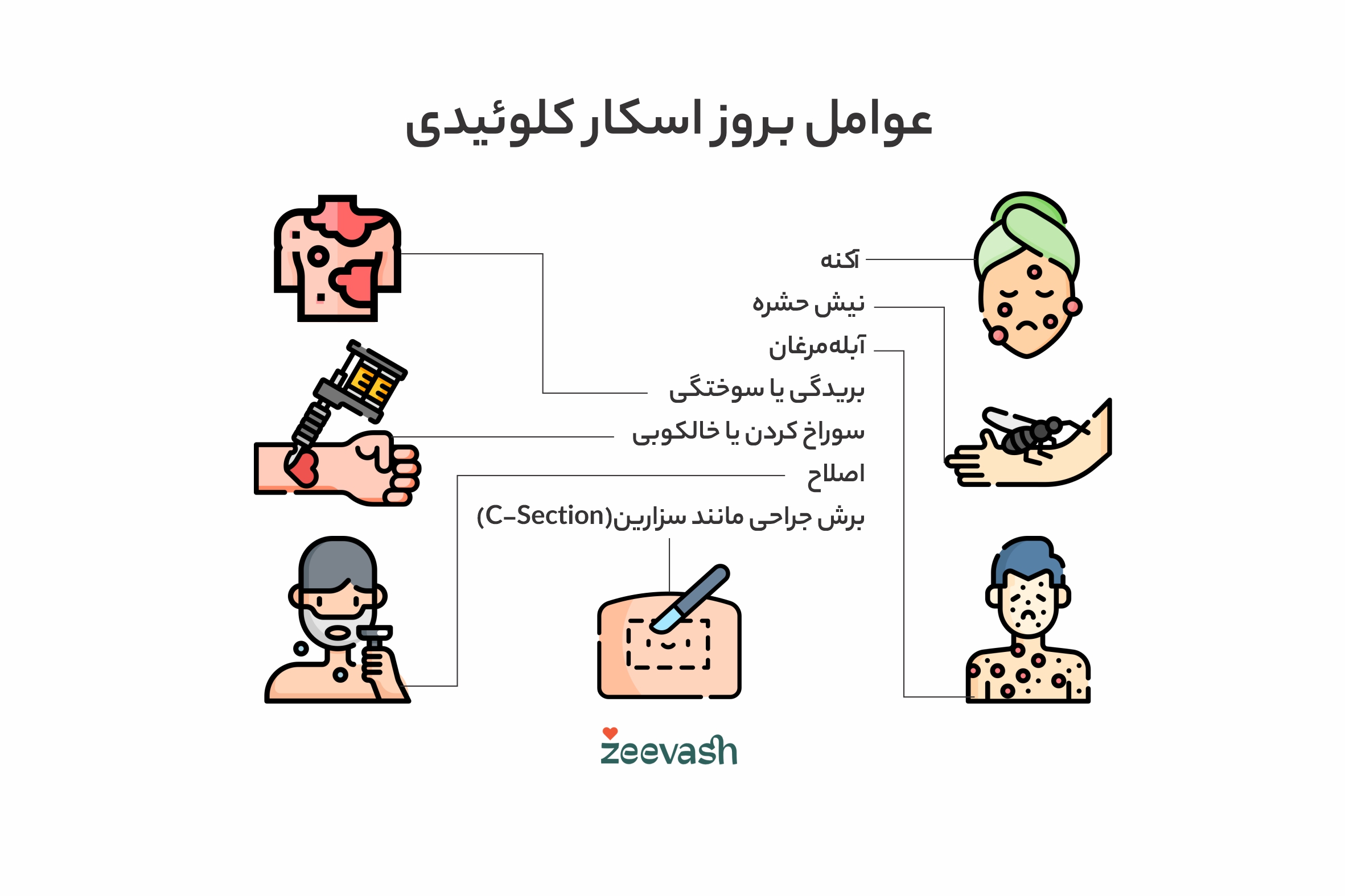عوامل بروز اسکار کلوئیدی